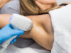 Permanent Hair Removal in Japan: My Experience